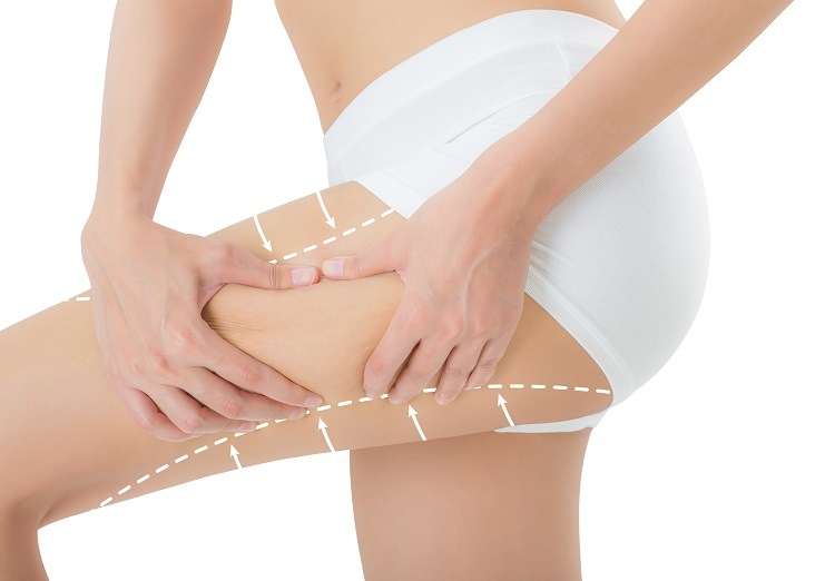 Thigh-Lift-2-Cape-Town- https://www.surgicalmatch.com/wp-content/uploads/2023/02/Thigh-Lift-2-Cape-Town-.jpg