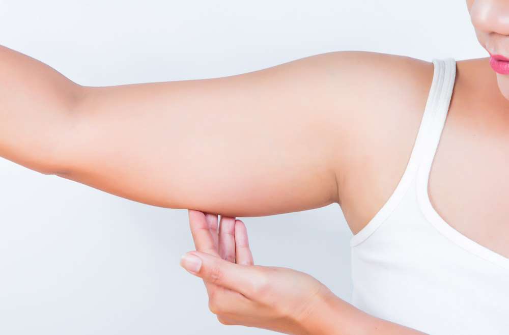 woman_showing_arm_tricep_681185050 https://www.surgicalmatch.com/wp-content/uploads/2023/02/woman_showing_arm_tricep_681185050.jpg