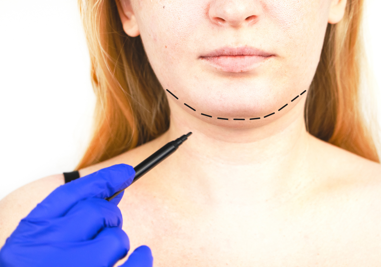 3 https://www.surgicalmatch.com/wp-content/uploads/2023/05/3.png