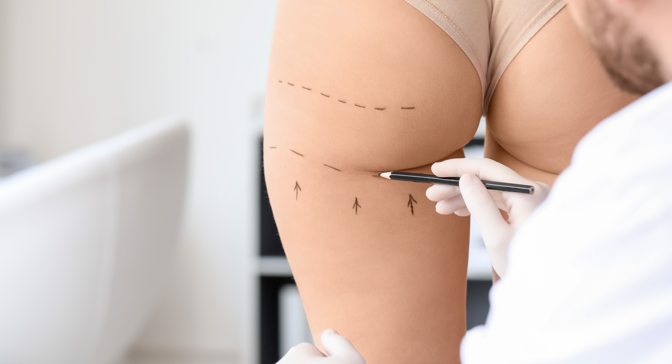 9 https://www.surgicalmatch.com/wp-content/uploads/2023/05/9.png